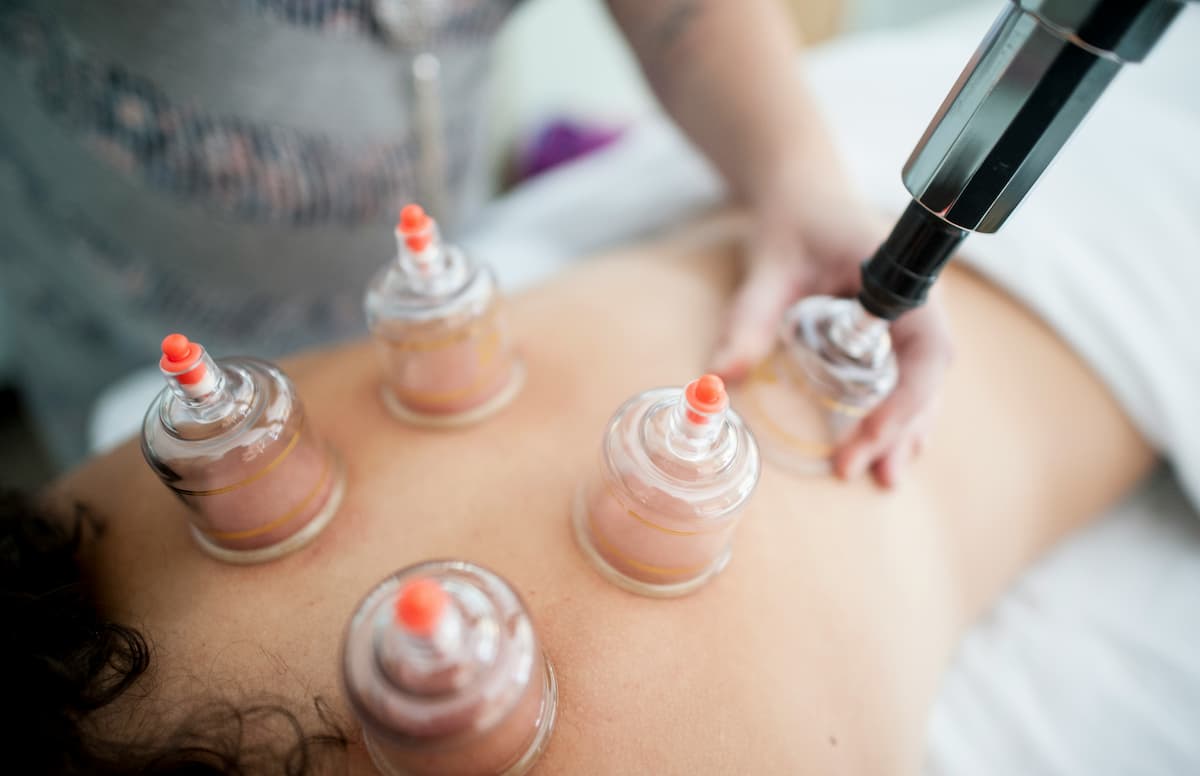 cupping a person's back