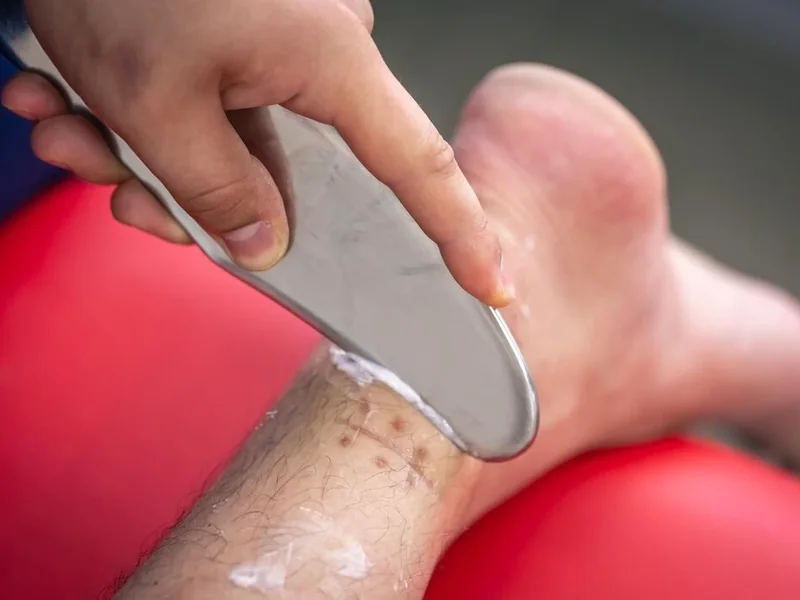IASTM treatment in Wylie